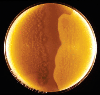 Image: Clostridium perfringens colonies cultured on a half-antitoxin plate (Photo courtesy of Dr. Stuart E. Starr).